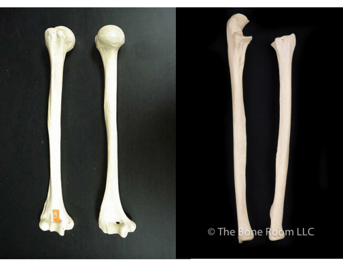 Arm Bone Crossword Clue Unlock the Skeletal Secrets Arm Bone Crossword Clue Unlock the Skeletal Secrets