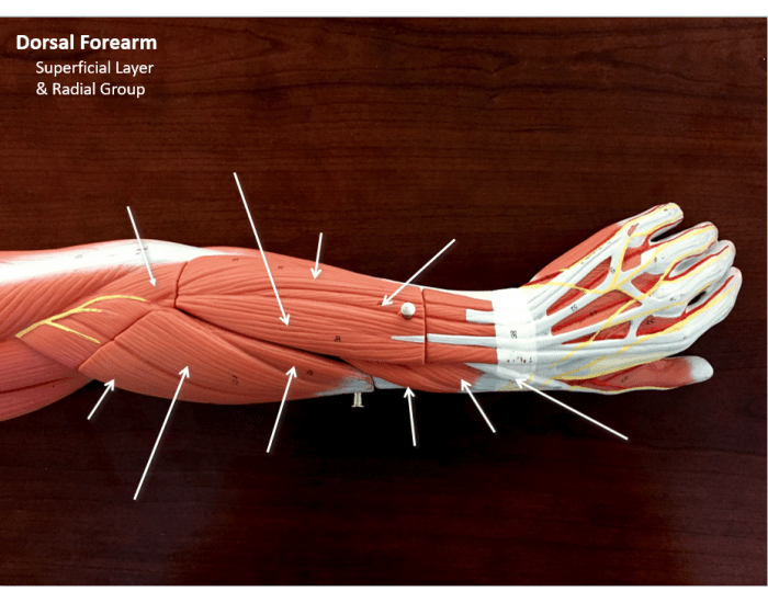 Dorsal Forearm: Superficial Layer and radial group Quiz