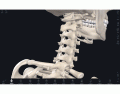 Bones & Joints of the cervical spine