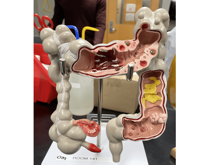 colon model Quiz