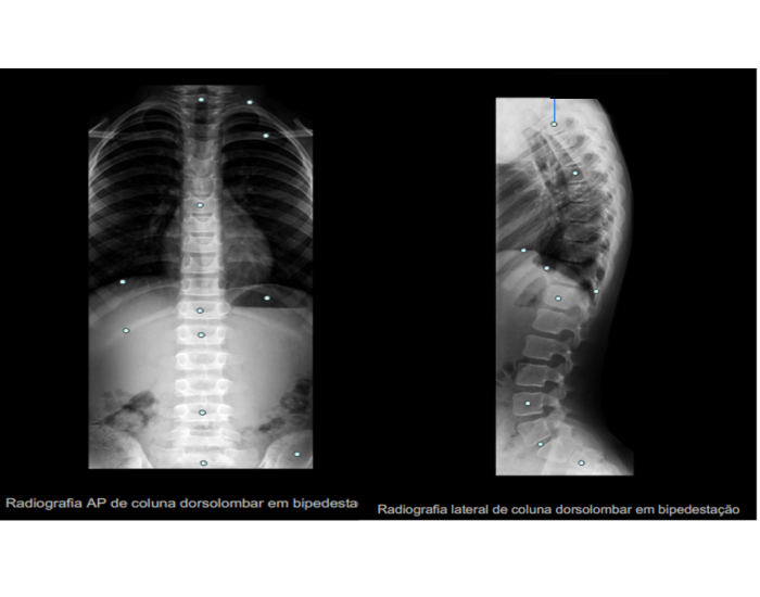 Anatomia Radiológica Col Vertebral - Torácica Quiz