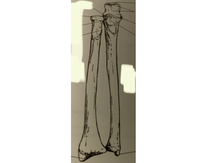 Radius and ulna and supination anterior view Quiz
