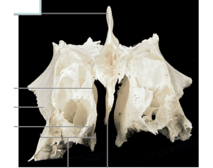 Ethmoid Bone Anterior View Printable Worksheet