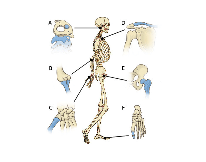 Joints Worksheet.pdf Joints of the Body Labelling Quiz — Printable Worksheet