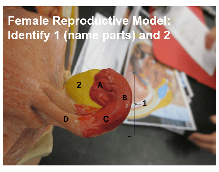 Fallopian Tube Model Label fallopian tube model Quiz