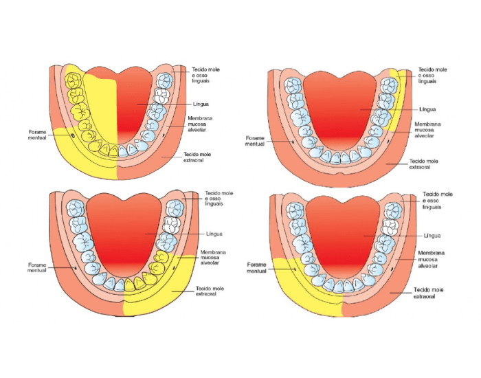 Anatomia da Mandíbula Quiz