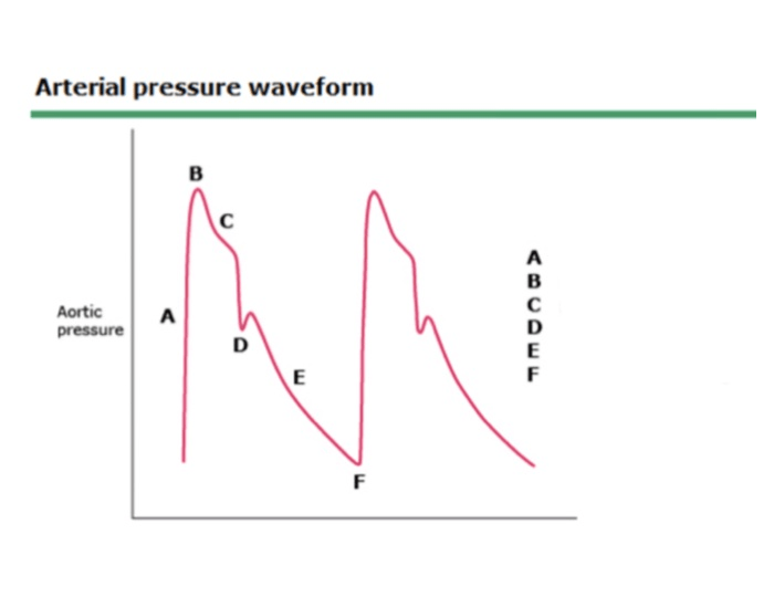 Arterial Pressure Waveform Quiz