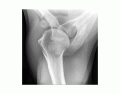 Axial Shoulder X-Ray Anatomy (Radiopaedia Image)