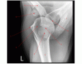 Axial Shoulder X-Ray Anatomy