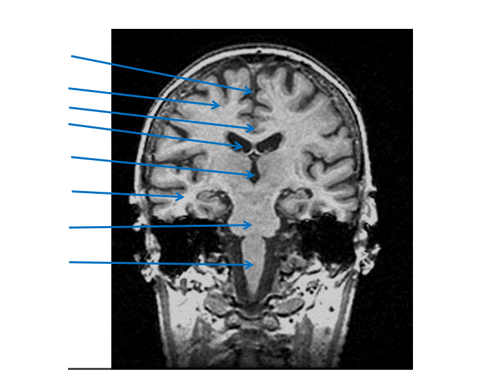 MRI brain labelling - pt 2 Quiz