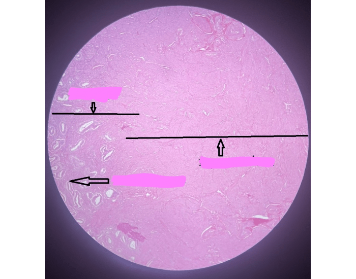 Basali S. basali & myometrium slide Quiz