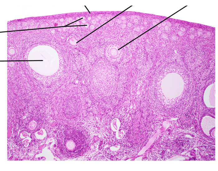 Ovary Sagittal Section Quiz