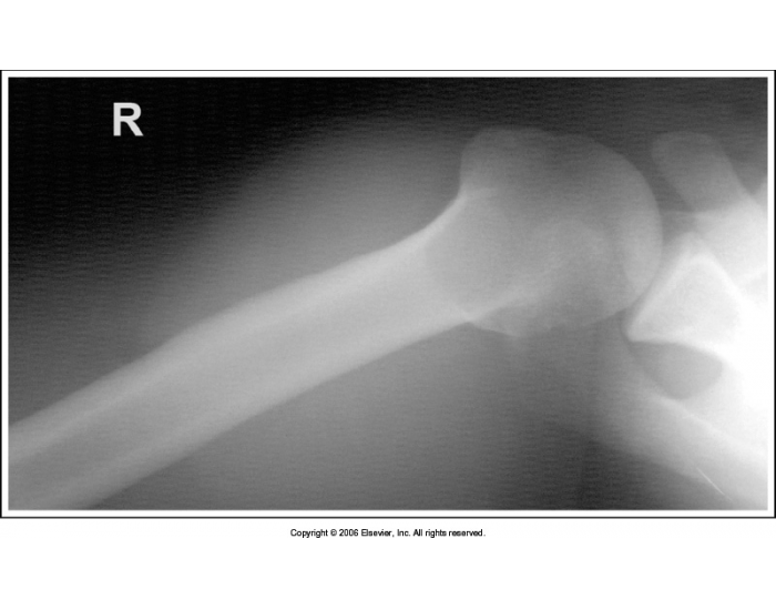 Inferosuperior Axial (Lawrence Method) Right — Printable Worksheet