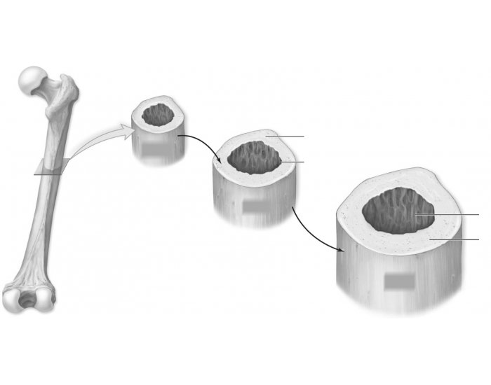 Bone Remodeling Quiz at Kellie Jackson blog