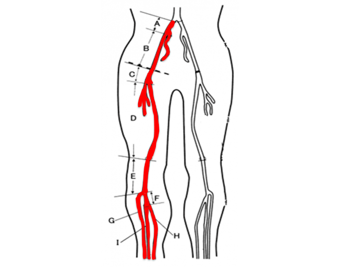 Lower Extremity Arterial Printable Worksheet