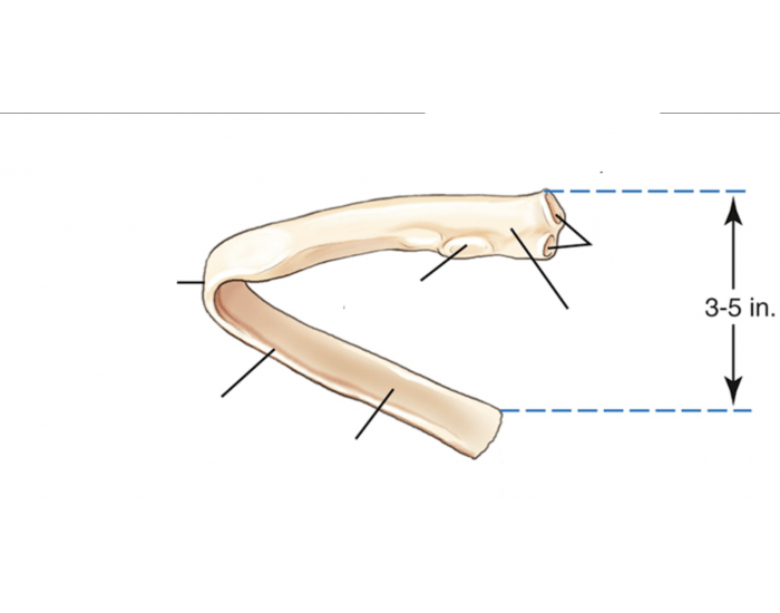 Posterior View 12 Rib Typical Rib- posterior view Quiz