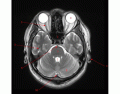 MRI Brain Anatomy