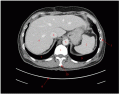 CT Anatomy- Abdomen 