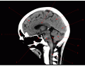CT - Brain Anatomy Imaging