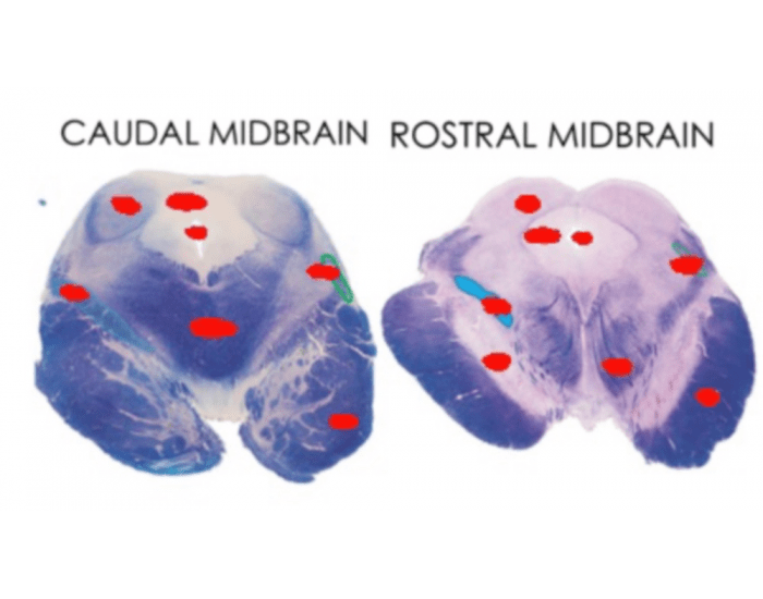 Caudal and Rostral Midbrain Quiz