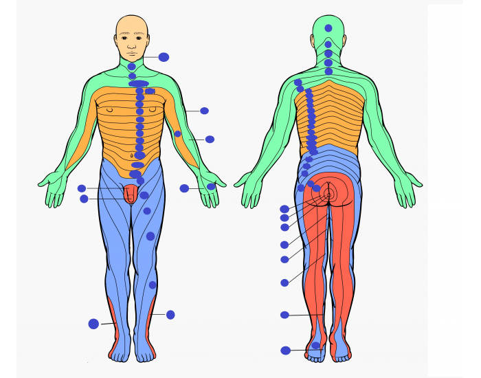 Dermo Map Dermatome map — Printable Worksheet