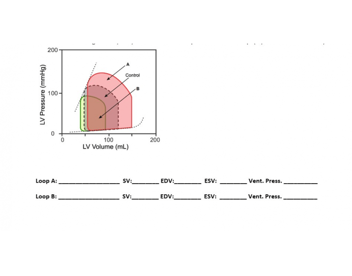 Preload Volume Preload Volume loop Quiz