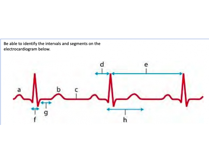EKG Identification Quiz