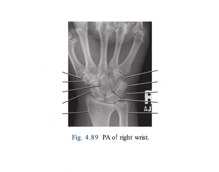 Right Pa Ranges PA of RIght Wrist Quiz