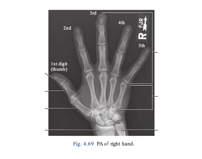 Right Pa Ranges PA of Right Hand Quiz