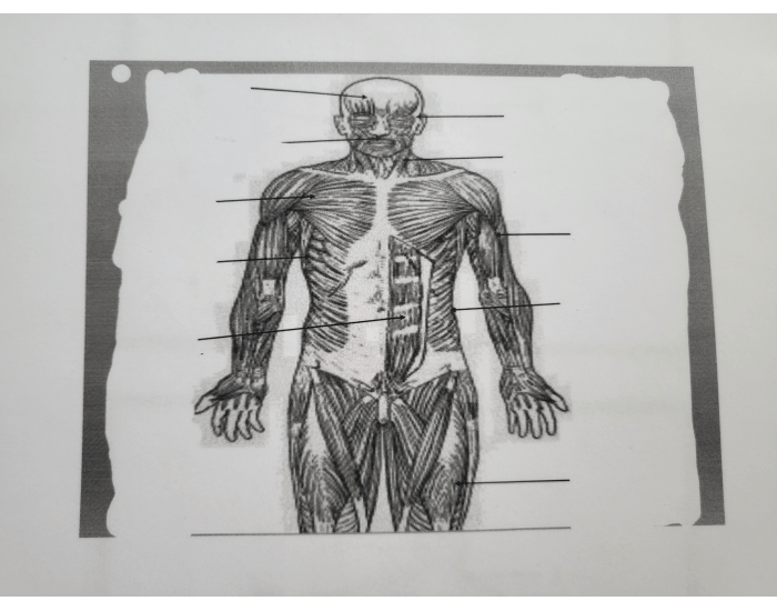 The Muscles Quiz