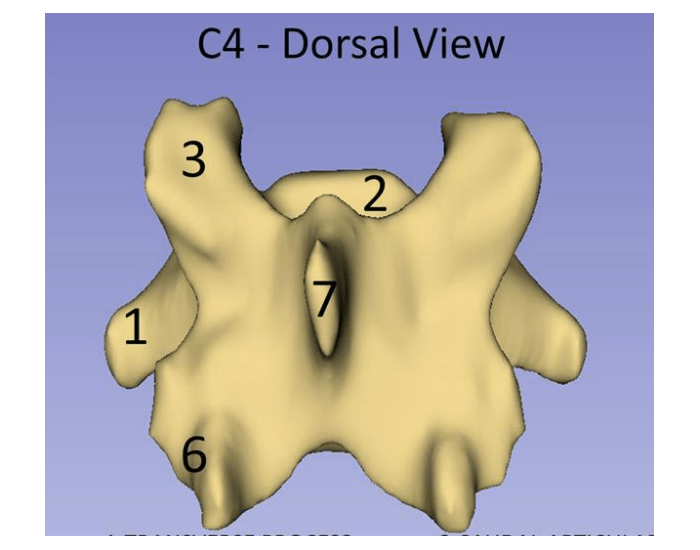 C4 View C4 (C3-C7) Dorsal View Quiz