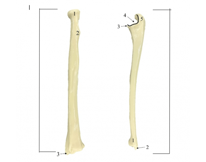 radius and ulna bone markings Quiz