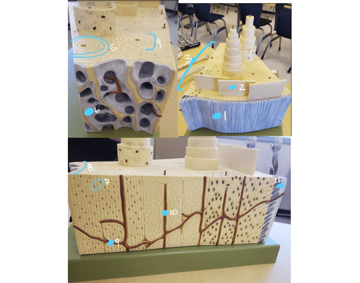 Name the parts of the bone model Quiz