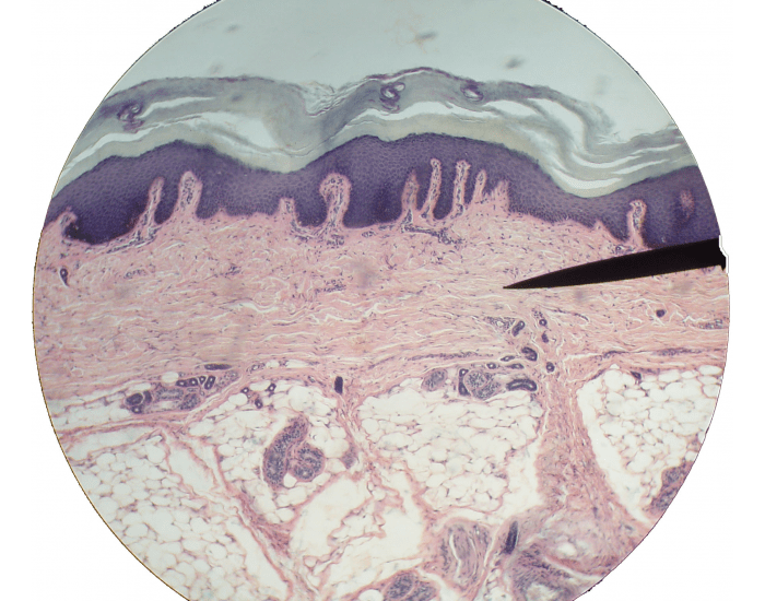 Thick Skin Microscope Labeling Quiz
