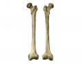 Femur Bone