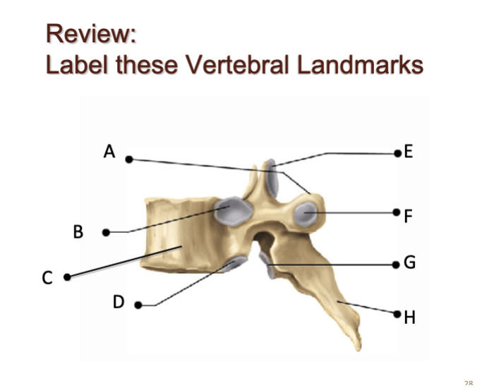 Vertebral Landmarks 1 Printable Worksheet