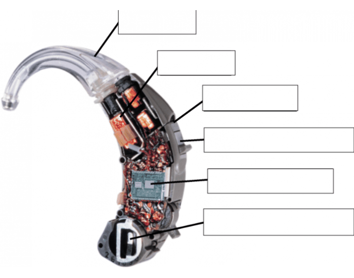 Bte Assembly BTE Components Diagram Quiz
