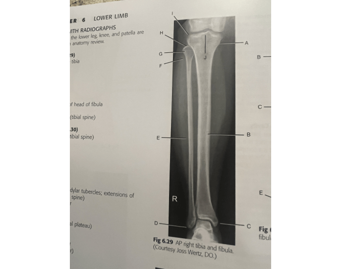 AP tibia fibula Quiz