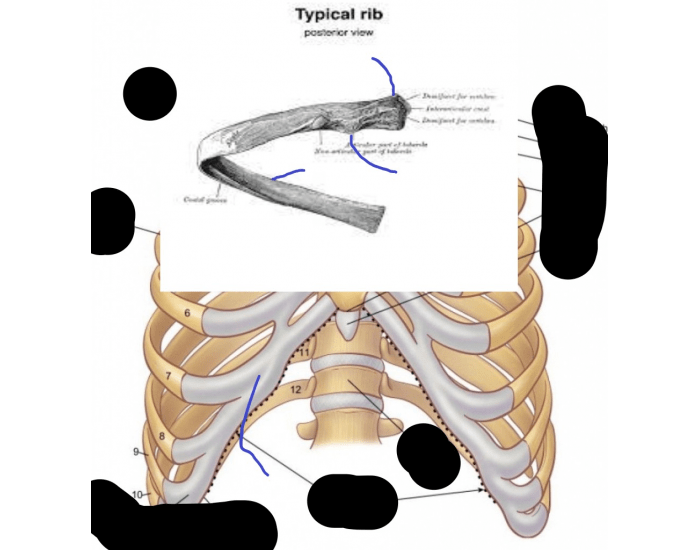 Different Rib Types Bodybuilding Name typical rib Quiz