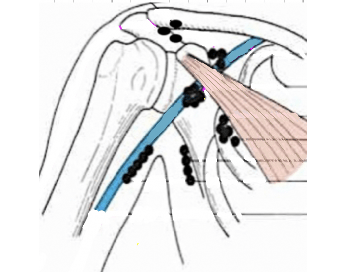 Upper Limb Lymph Nodes Quiz Upper Limb Lymph Nodes Quiz