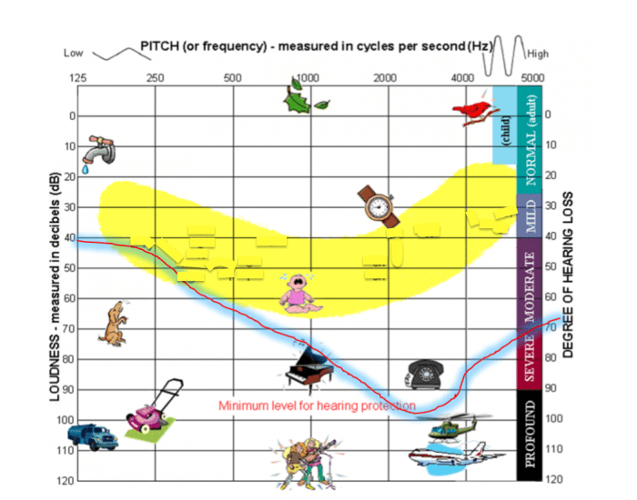 Audiogram Speech Banana Quiz