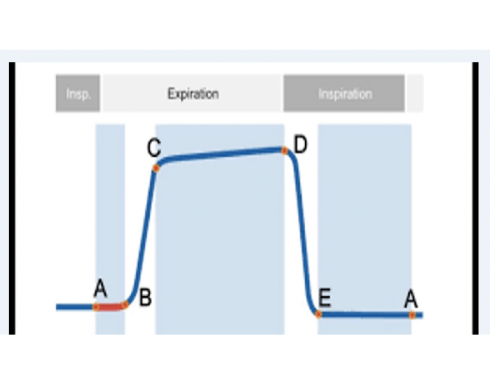 Phases of Capnogram Quiz