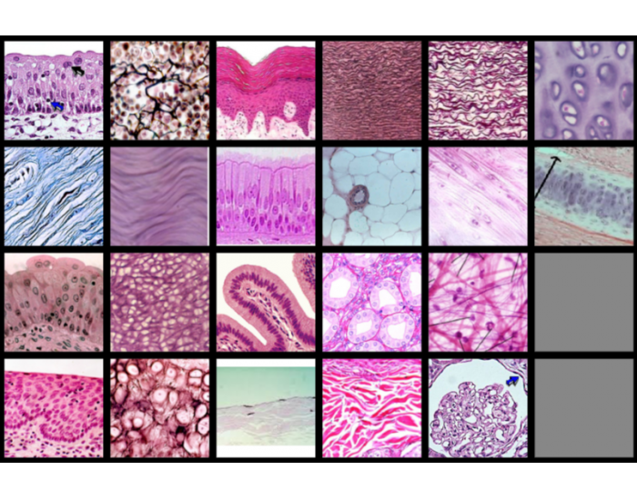 Tissue Practice Tissue Quiz
