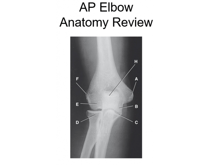 Elbow Labr Radiograph AP Elbow Radiograph Quiz