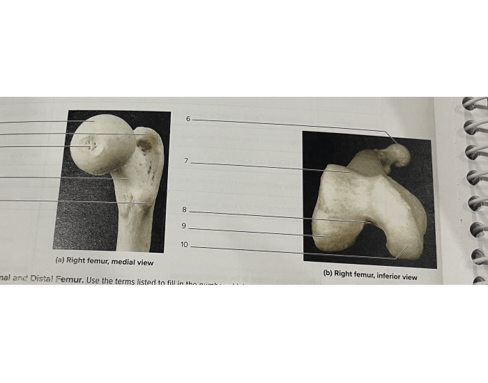 Proximal & Distal Femur — Printable Worksheet