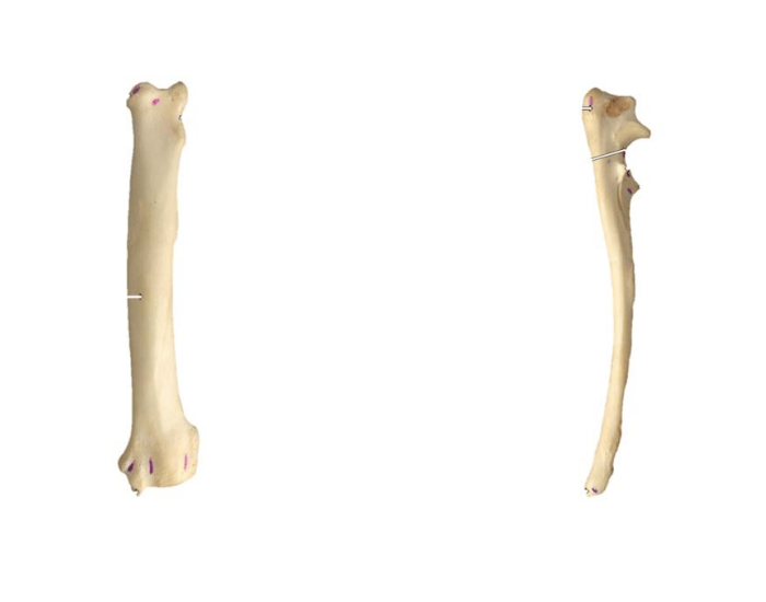 bony landmarks of radius and ulna — Printable Worksheet