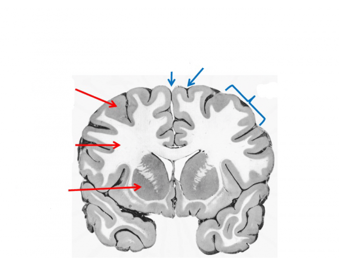 Gross Anatomy of the Cerebellum Quiz Biology Diagrams