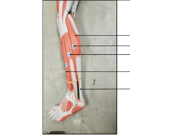Leg Quiz