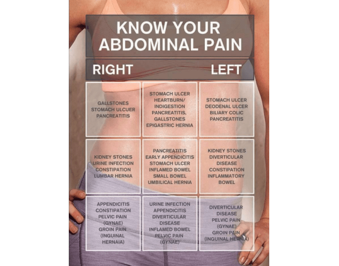 Know your abdominal pain Quiz