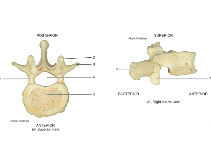 Lumbar Vertebrae Moose Printable Worksheet